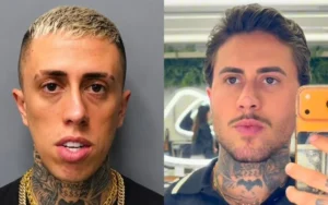 MC Daniel impressiona com antes e depois após procedimentos estéticos e fãs brincam: “Outro CPF”
