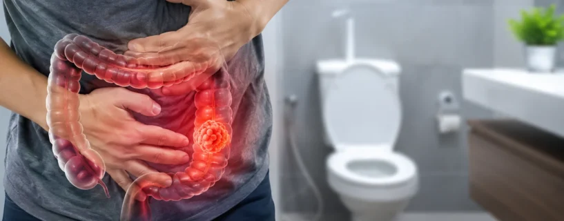 Câncer de intestino avança entre jovens e primeiros sinais costumam aparecer no banheiro